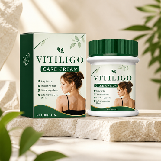 Vitiligo Pflegecreme – Nährende Hautpflegeformel für ein ausgeglichener wirkendes Hautbild